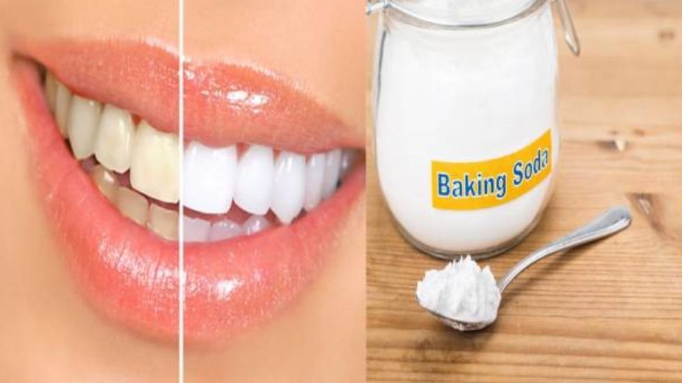 baking soda làm trắng răng